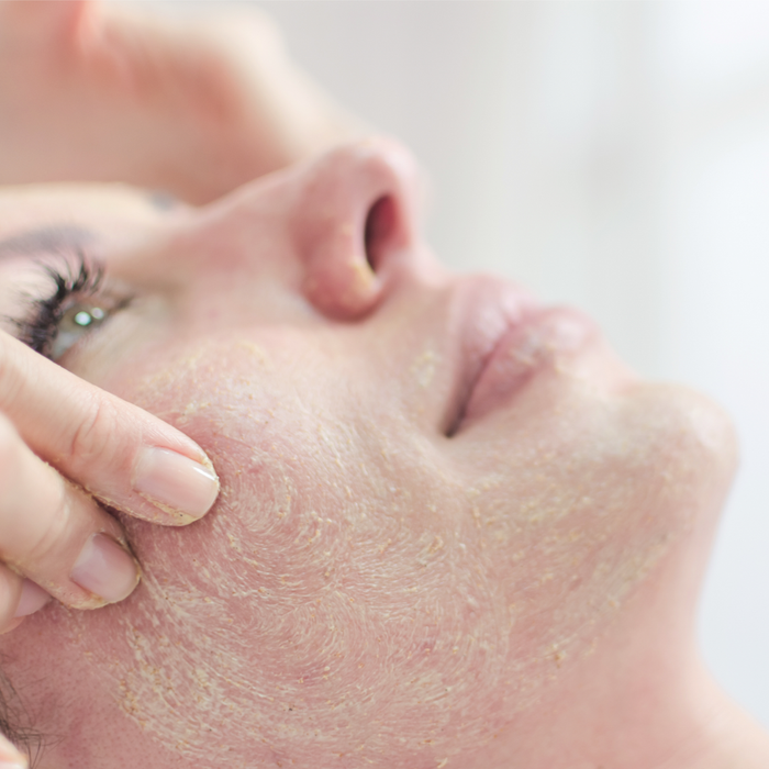 Close-up of a person receiving a gentle facial exfoliation treatment with a textured cream, showcasing a skincare routine using Rice Flower Polish 50g | Privai for smooth, refreshed skin.