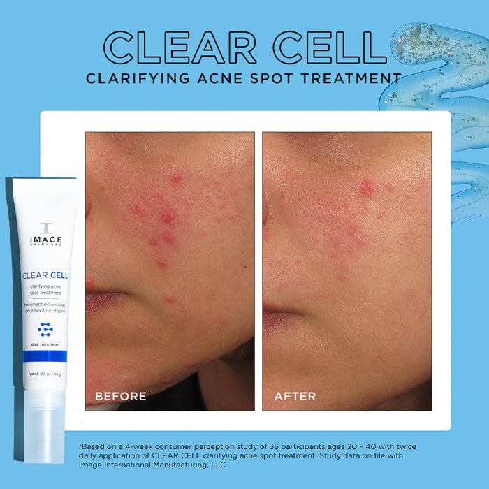 Before and after comparison of facial skin showing reduced redness and fewer acne spots using CLEAR CELL clarifying acne spot treatment | IMAGE Skincare for clearer skin.