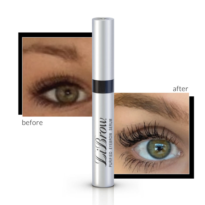 Close-up of an eye showing before and after results of using LiBrow® Purified Eyebrow Serum (3 & 6 Month Supply) | LiLash Beauty for enhanced eyebrow fullness and definition.