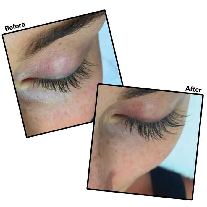 Before and after close-up comparison of eyelashes showing enhanced length and fullness after using LiLash Purified Eyelash Serum (3 & 6 Month Supply) | LiLash Beauty.