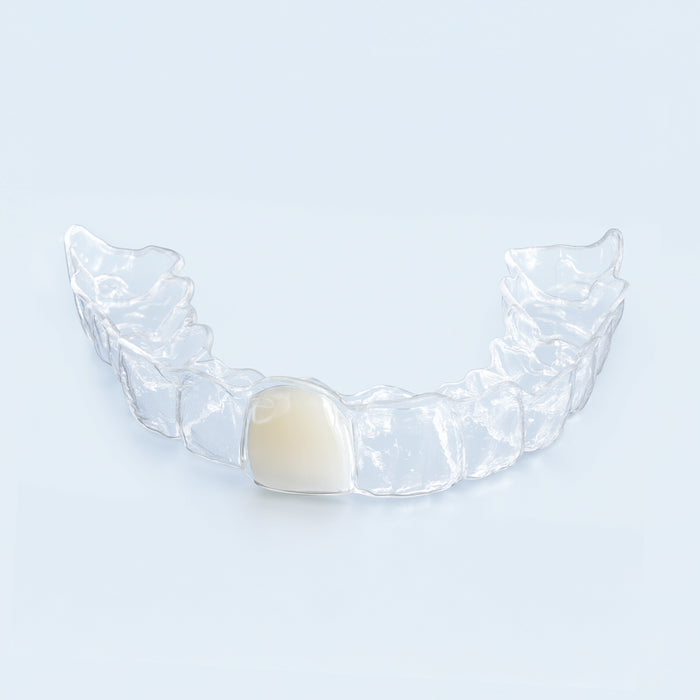 Clear upper retainer with built-in replacement tooth on blue surface for missing tooth
