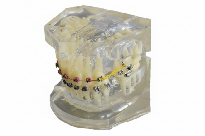 Ortho Model