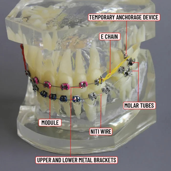Ortho Model